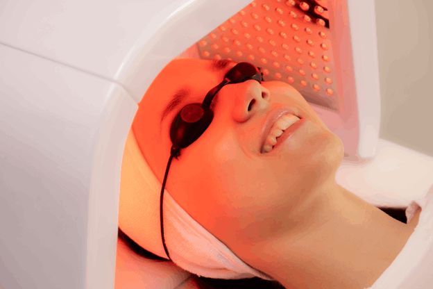 Phototherapy for acne